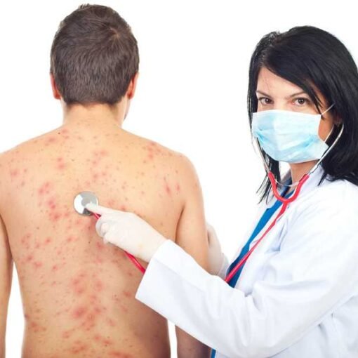 Medico examinando paciente con urticaria