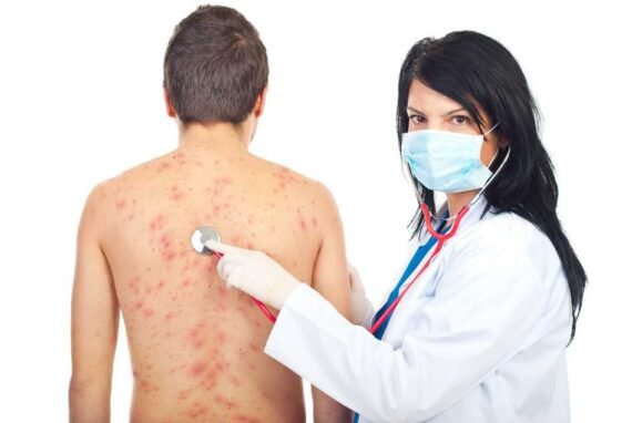 Medico examinando paciente con urticaria